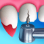 Dentist Bling MOD APK v1.0.4 (Unlimited Money) Android